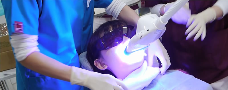 ホワイトニング